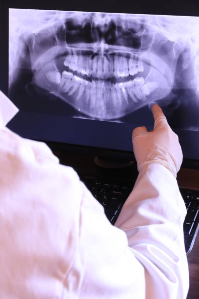 Best Knocked-Out Tooth (Avulsed Tooth) Treatment in Pea Ridge, AR