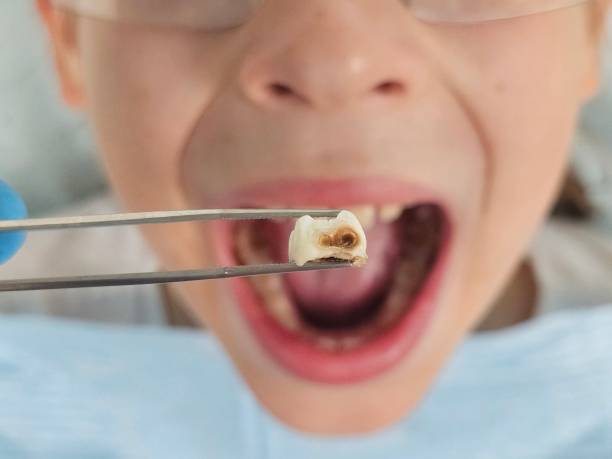 Best Emergency Care for Gum Disease in Pea Ridge, AR