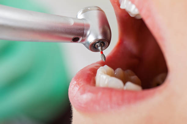 Best Emergency Denture Repair in Pea Ridge, AR